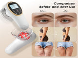 Modern Jingluo Beauty Massager Electric Meridian Facial & Body Roller with Gentle Suction and V1107-CS-JLMRY