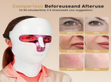 Red Light Therapy Mask for Face and Neck, LED Light Therapy Masks, USB-C Rechargeable, Facial V1107-110-63876
