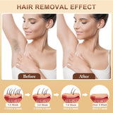 IPL Hair Removal Device - 3-in-1 Permanent Hair Reduction, Skin Rejuvenation & Acne Control V888-ELOSUNG35680