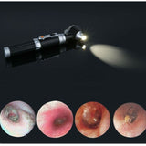 Mini Ear Otoscope, Magnification Diagnostic Inspection Ear Scope with LED Direct Illumination Ear V1237-ZY-715-324