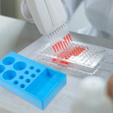 Sky Tube Rack and Stool Sampling Tray for Hospital and Laboratory Use 1 Set V1192-AZ-W-22603