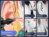 E30 Professional Electric Ear Irrigation and Ear Wax Removal Kit - Type-C Charging, 4 Pressure V888-ELOSUNG49833