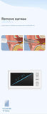 All-in-One Wireless Visual Ear Cleaner Kit with 4.3" IPS Display Screen V888-ELOSUNG35839