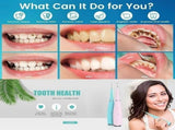 Electric Teeth Cleaner,Tooth Scraper for Plaque and Stain,Waterproof Tartar Remover for Teeth V1192-AZ-W-17560