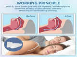 Anti-Snoring Mouthpiece - Reusable, FDA-Cleared, with Case V1263-JX-6032