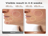 High-Performance 3D LED Beauty Mask 4 Light Modes, 328 LEDs, Wireless Operation, Adjustable Timer, V1107-CS-NFMRYMZ