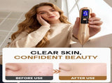 9-Speed Skin Tag Remover Pen - USB Rechargeable Mole Wart Removal Tool, LCD Display & Safety Lock, V1107-110-51887-PUR-19CM