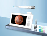 All-in-One Wireless Visual Ear Cleaner Kit with 4.3" IPS Display Screen V888-ELOSUNG35839