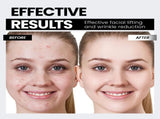 Microcurrent Facial Device,Latest Red Light TechnologyEnhances The Ability to Lift The Face and V1107-110-32898-PNK-15CM