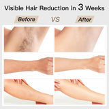 Laser Hair Removal, BoSidin IPL Hair Removal with Painless Ice-Cooling, 2-in-1 Face SR Rejuvenation, V1265-D-1178