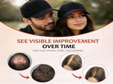 Laser Hair Growth Cap - 650nm Red Light Therapy for Hair Regrowth, Full Scalp Coverage Treatment for V1107-110-47484