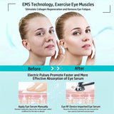 Eye Beauty Device Eye Care Anti-Aging Dark Circles Puffiness Fine Lines V1107-135-09371