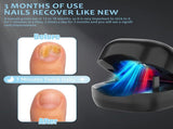 Nail Wellness Light Device Red & Blue LED for Daily Nail Care Routine Auto Timer, USB V1107-CS-ZJD