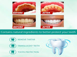 Foam Toothpaste Breath Freshening Whitening Toothpaste Tooth Anti-Moth Mouth Cleaning Tooth Stains V201-W13288640