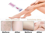 Skin Epilator, New, Glamorous Facial Hair Remover for Women Face, Shaver with Led Light for V1192-AZ-W-17670