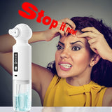 Blackhead Cleaner Vacuum Pore Cleaner Electric Blackhead Remover USB - White - Size 001 V1106-111-12425-WHT-001