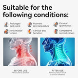 Large Posture Corrector for Neck & Cervical Spine Alignment - 360&deg Adjustable Neck Collar with 28 V1107-108-92140-GRY-L