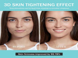 Upgraded Version Skin Care Device - Facial Glow Booster for Maximizing and Boosting Absorption V1107-110-91465