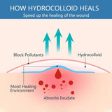 2 Rolls Hydrocolloid Roll for Wound Care, 2in x 16.5ft Self-Adhesive Hydrocolloid Bandages for V1370-AZ4-17789