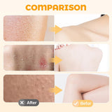 Super Soft Sunflower Suction Cup Bath Ball, 2026 New Exfoliating Bath Bath Sponge Cleaning Brush V1258-DP02-F-24